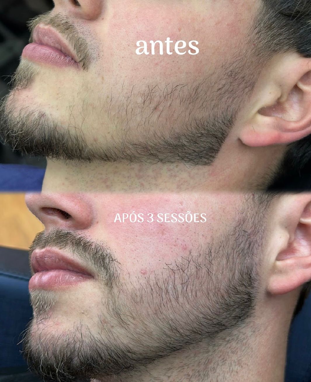 Falhas na Barba